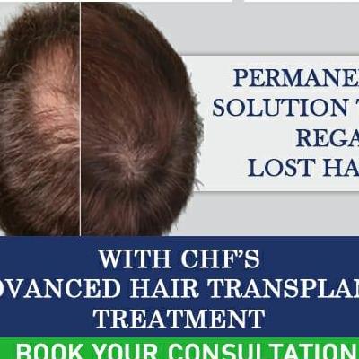 CFH HairTransplant